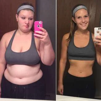 A patient before and after, side by side
